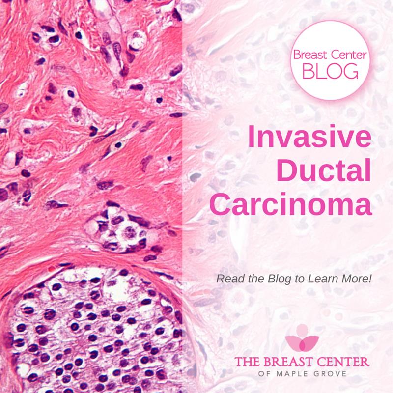 Invasive Ductal Carcinoma