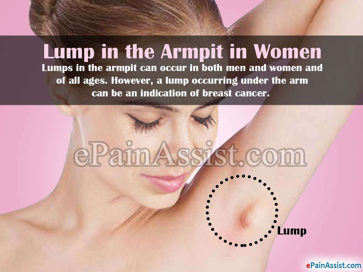 Is Armpit Pain A Sign Of Breast Cancer / Early Signs Of Breast Cancer ...