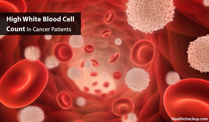 Is High White Blood Cell Count Cancer