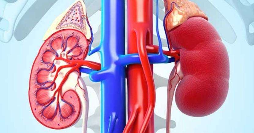 Is Stage 4 Kidney Cancer Terminal