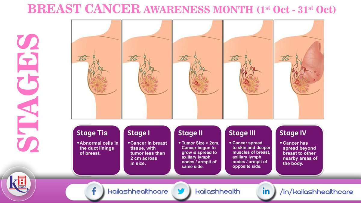 Kailash Hospital on Twitter: " #BreastCancerAwarenessMonth #Cancer # ...