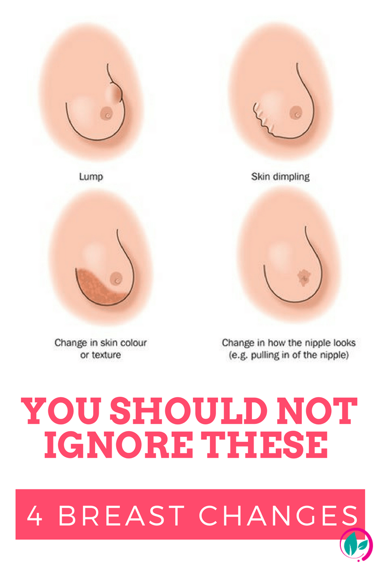 Ladies You Should Never Ignore These 4 Breast Changes!