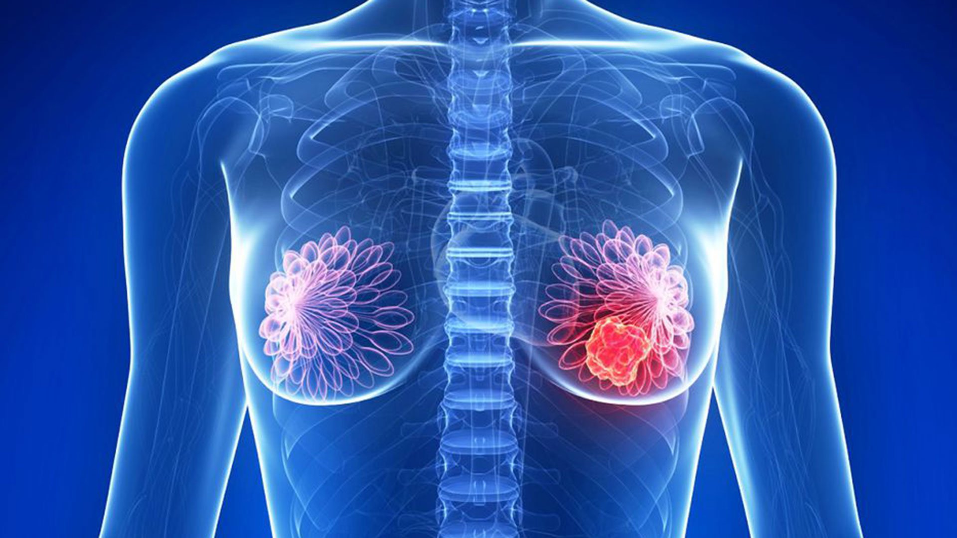 Lung Cancer Treatment in Mumbai