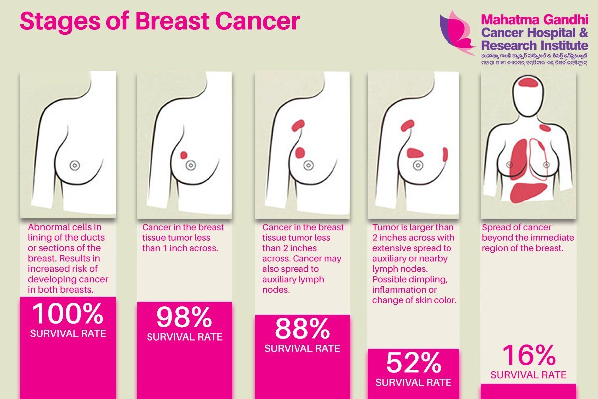 Mahatma Gandhi Cancer Hospital on Twitter: " #BreastCancer ...