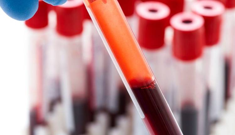 New blood test could spot breast cancer five years before ...