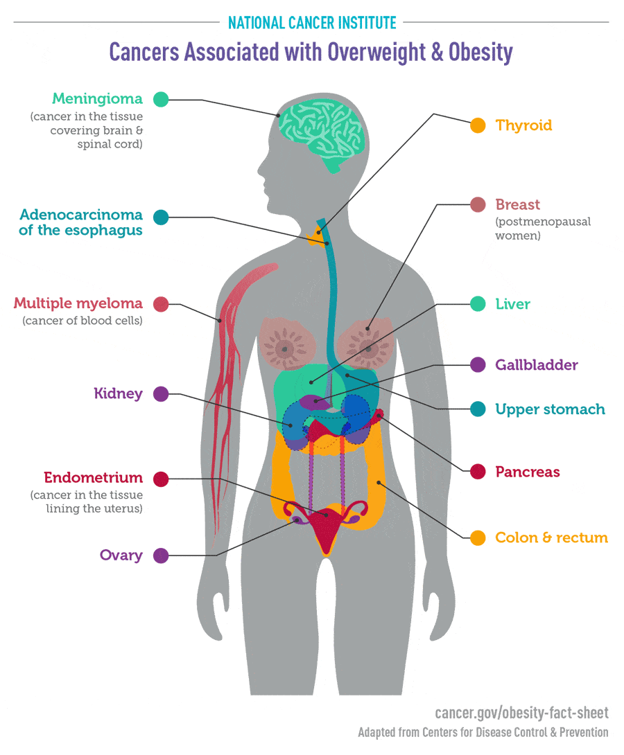 Obesity and Cancer Fact Sheet