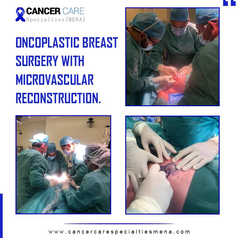 Oncoplastic Breast Surgery with microvascular reconstruction.