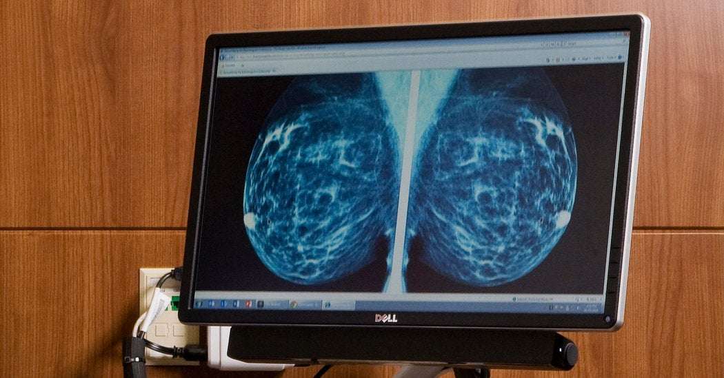 Panel Reasserts Mammogram Advice That Triggered Breast Cancer Debate ...