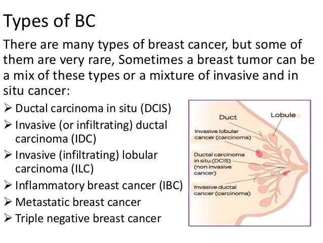 Presentation on breast cancer