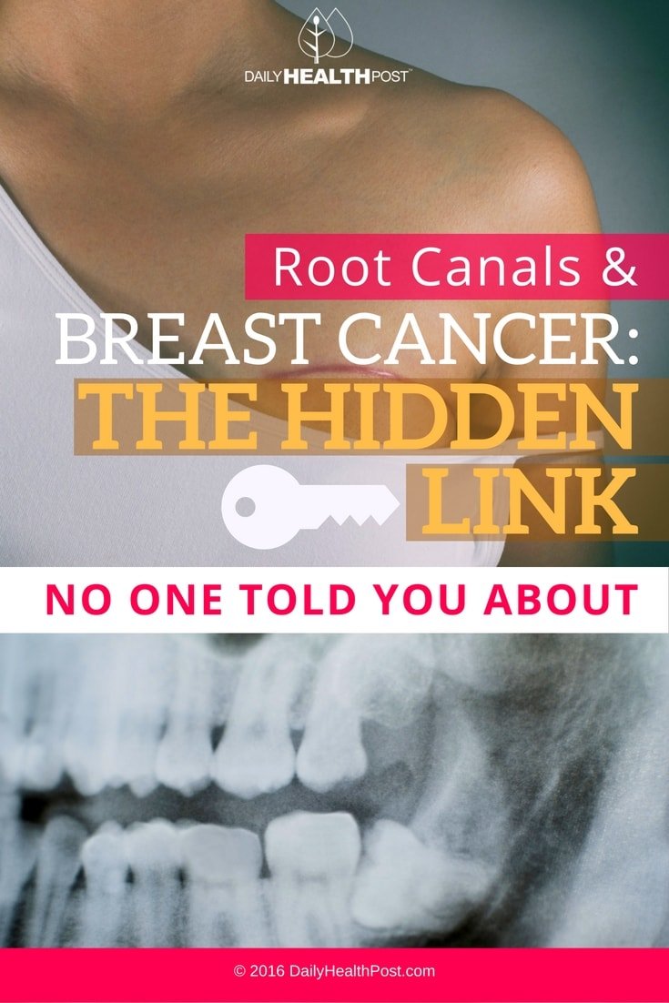 Root Canals And Breast Cancer: The Hidden Link No One Told ...