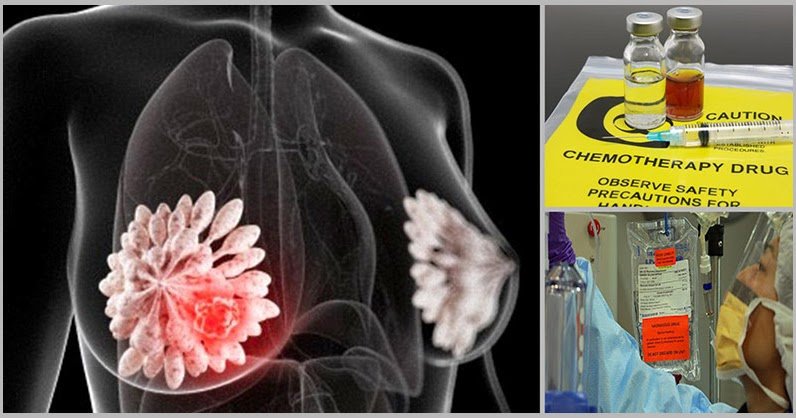 Science Confirms: Chemotherapy Can Actually Trigger The ...