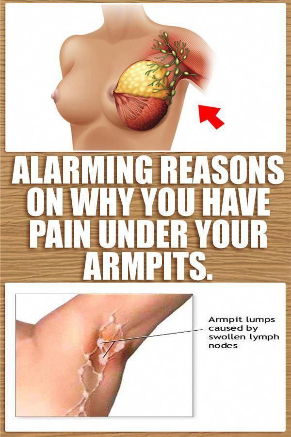 Sharp pains and painful lumps in your armpits? Here are ...