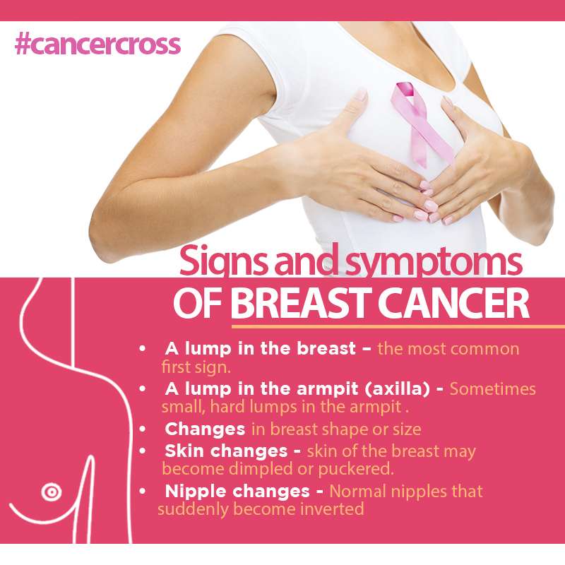 Signs of breast cancer