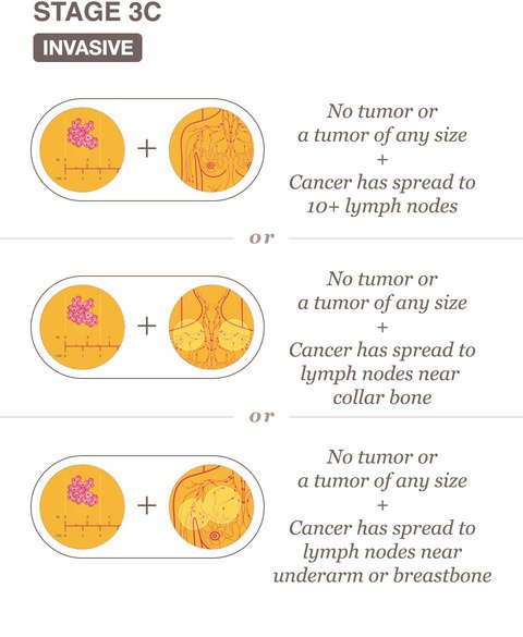 what-does-stage-3a-breast-cancer-mean-breastcancertalk