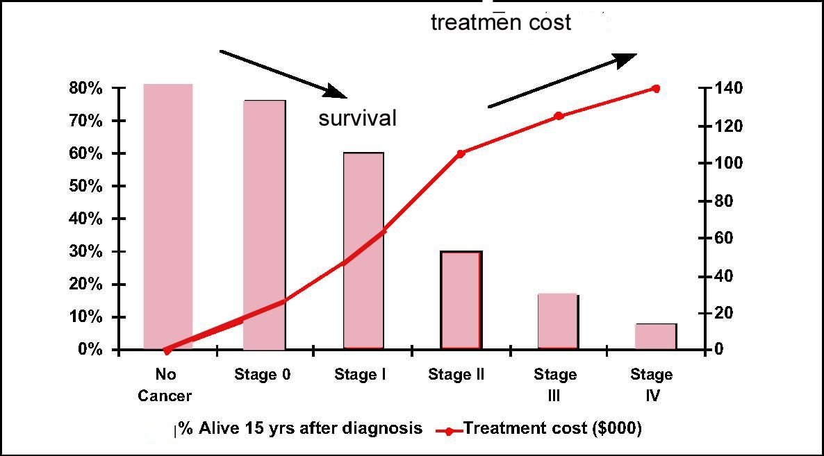 Stage 4 Kidney Cancer Survival Rate
