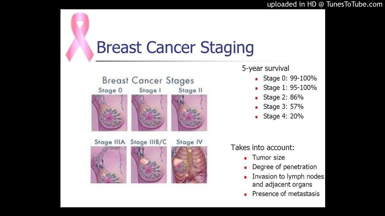 Stage IV Metaplastic Breast Cancer in Which Primary Tumor ...