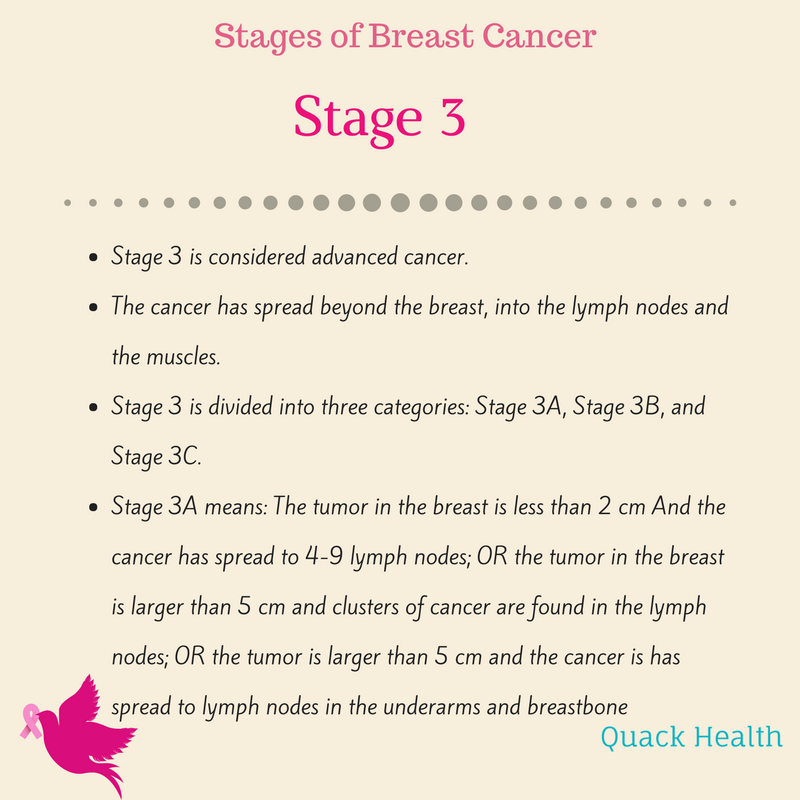 Stages of Breast Cancer  Quack Health