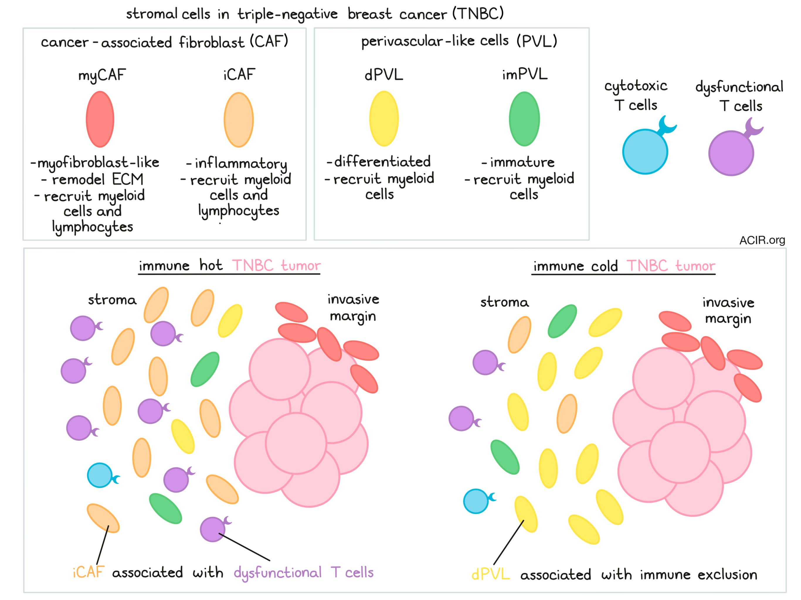 Stromal cells affect immune infiltrate in triple