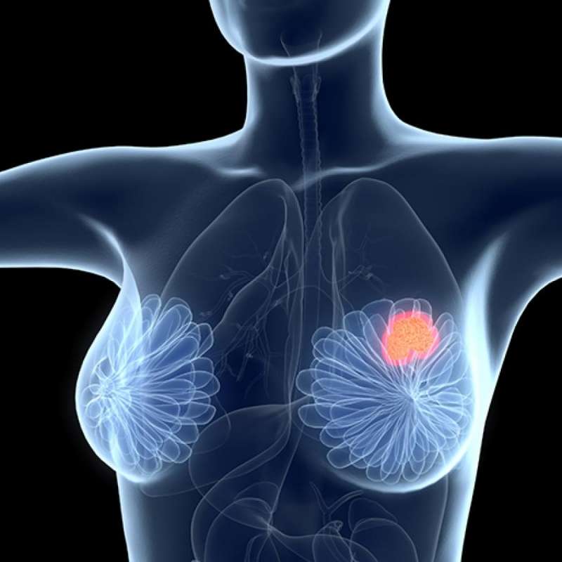 Study Shows How BPA May Affect Inflammatory Breast Cancer