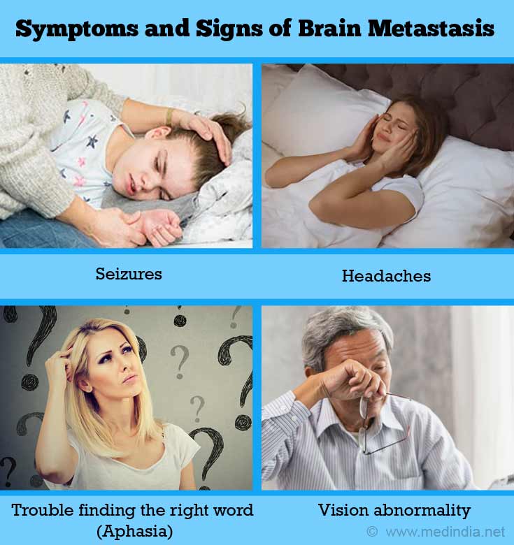 Symptoms and Signs of Brain Metastasis