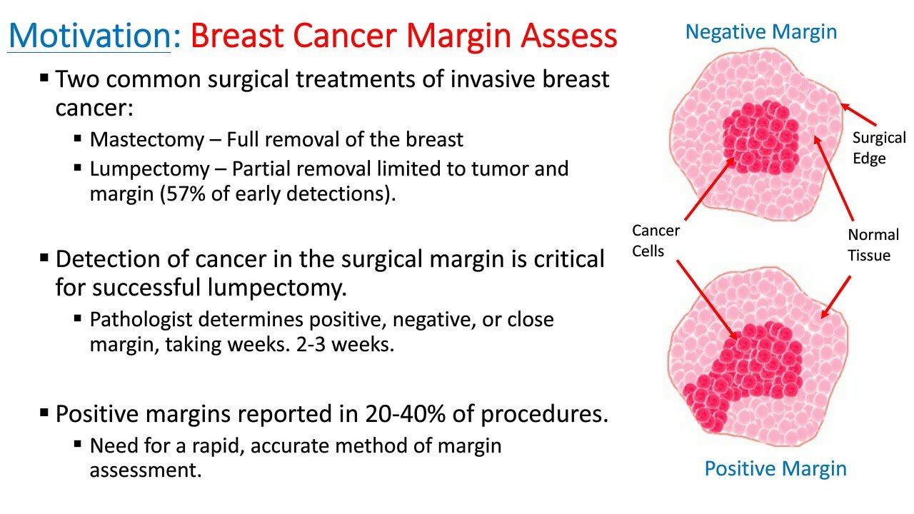 Terahertz Imaging for Margin Assessment of Excised Breast ...