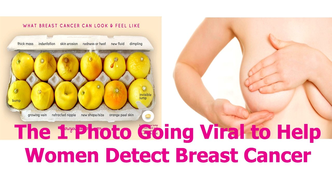 The 1 Photo Going Viral to Help Women Detect Breast Cancer ...