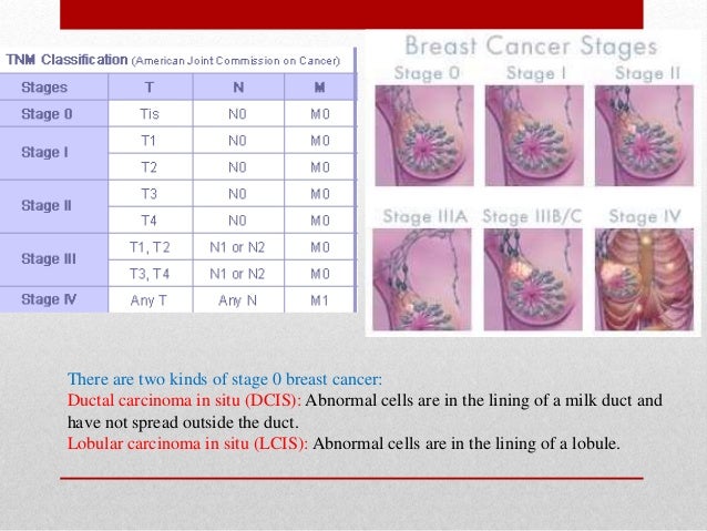 the breast cancer and its different type ,stages and grading , the tâ¦