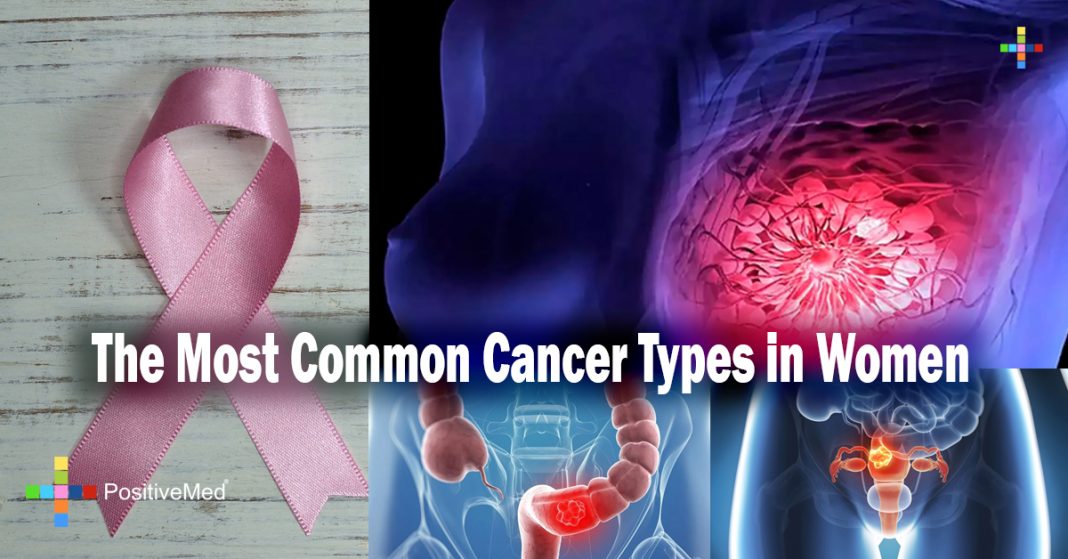 The Most Common Cancer Types in Women
