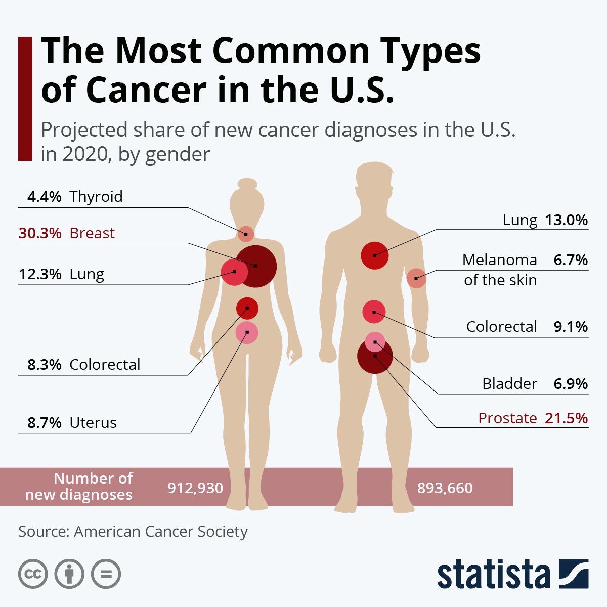 The Top 10 Cancers in the USA #Infographic