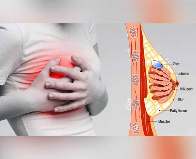 These Reasons Cause Breast Pain &  Here Is How You Can Avoid It