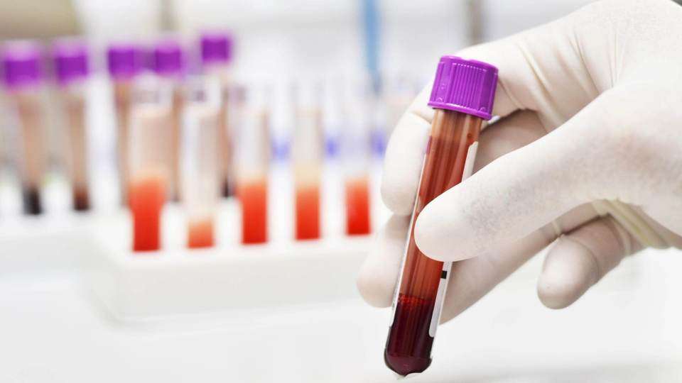 This New Breast Cancer Blood Test Is 100 Times More Sensitive Than ...