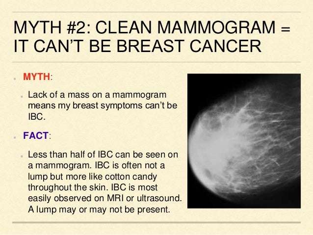 Top 10 Inflammatory Breast Cancer (IBC) myths
