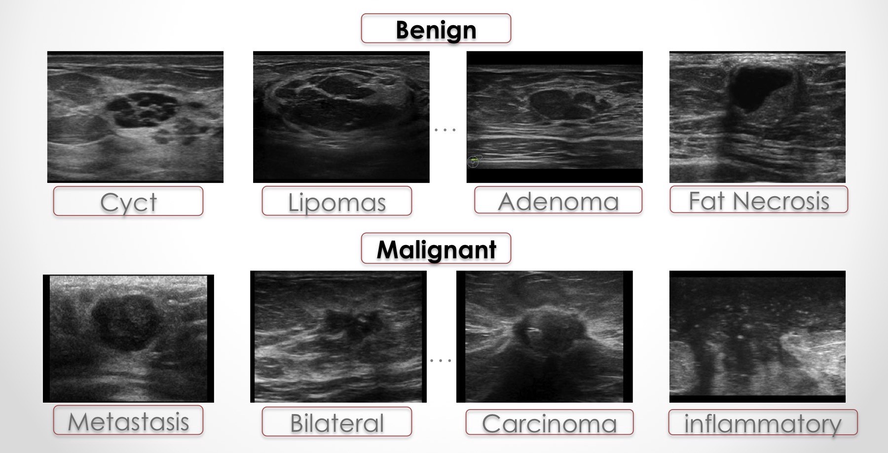 Transfer Learning for Breast Lesion Detection from Ultrasound Images ...