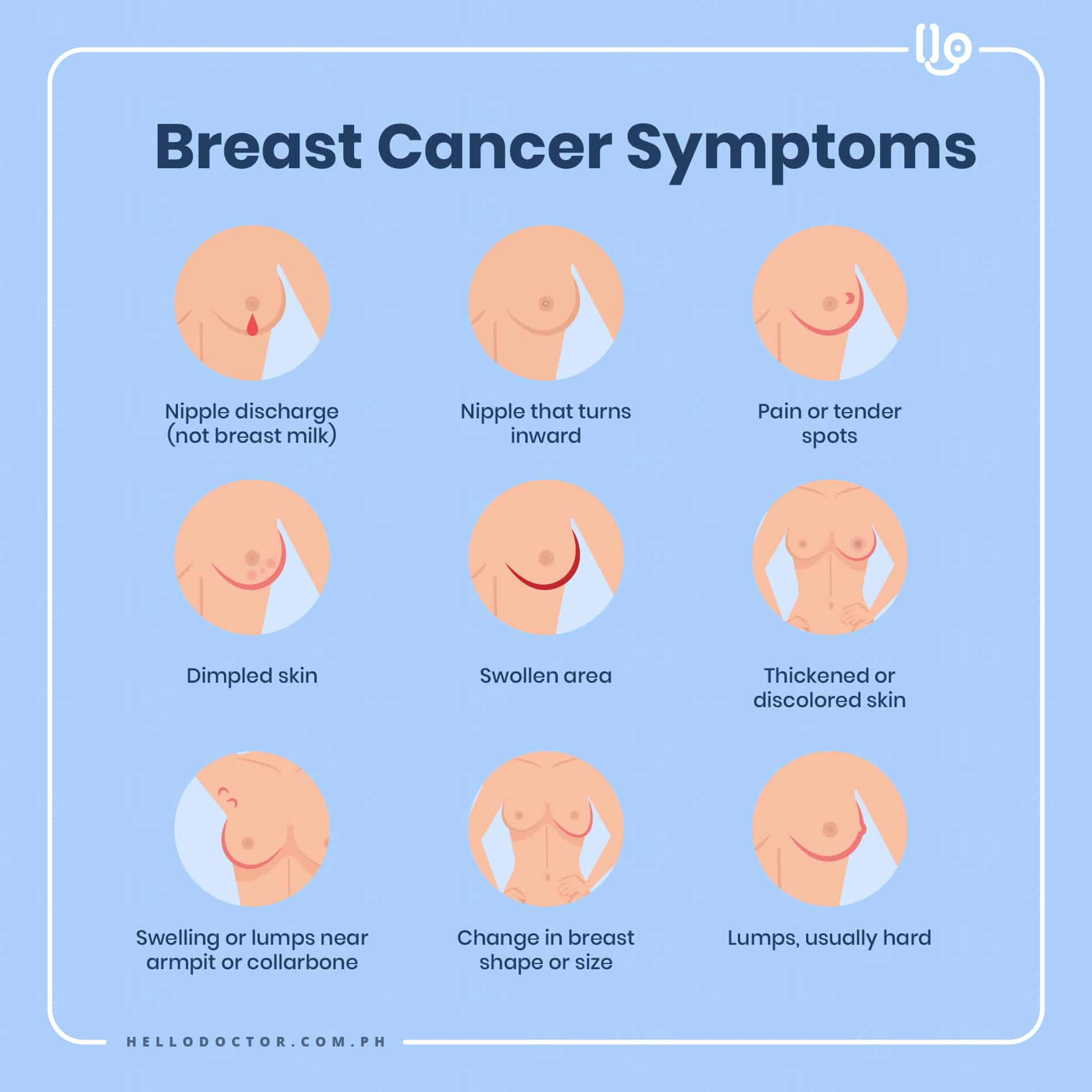 Types of Breast Cancer Every Woman Should Know About