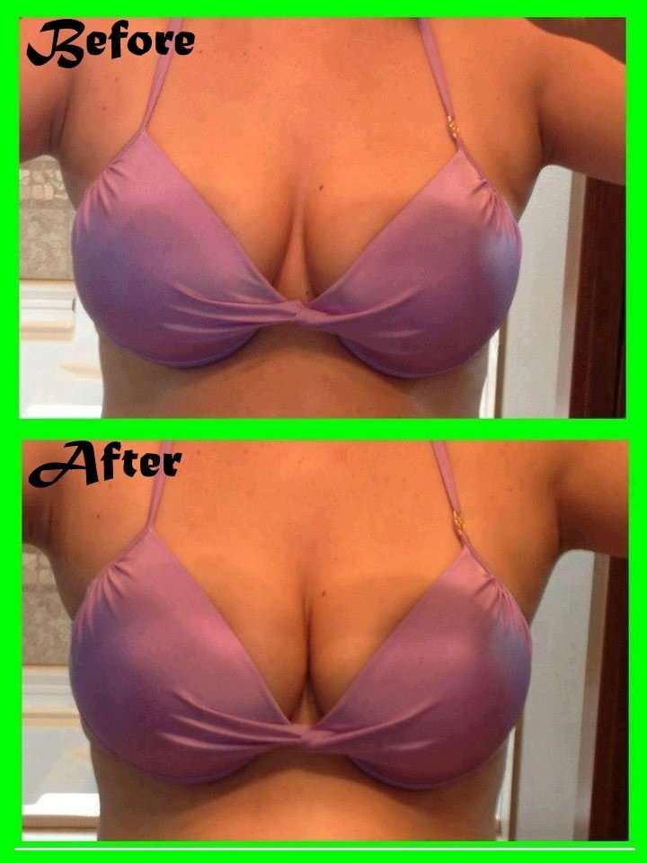 Ultimate Body Applicator Breast lift Results! Get a breast ...