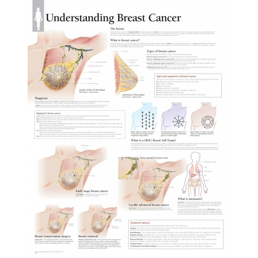 Understanding Breast Cancer Chart from Scientific Publishing