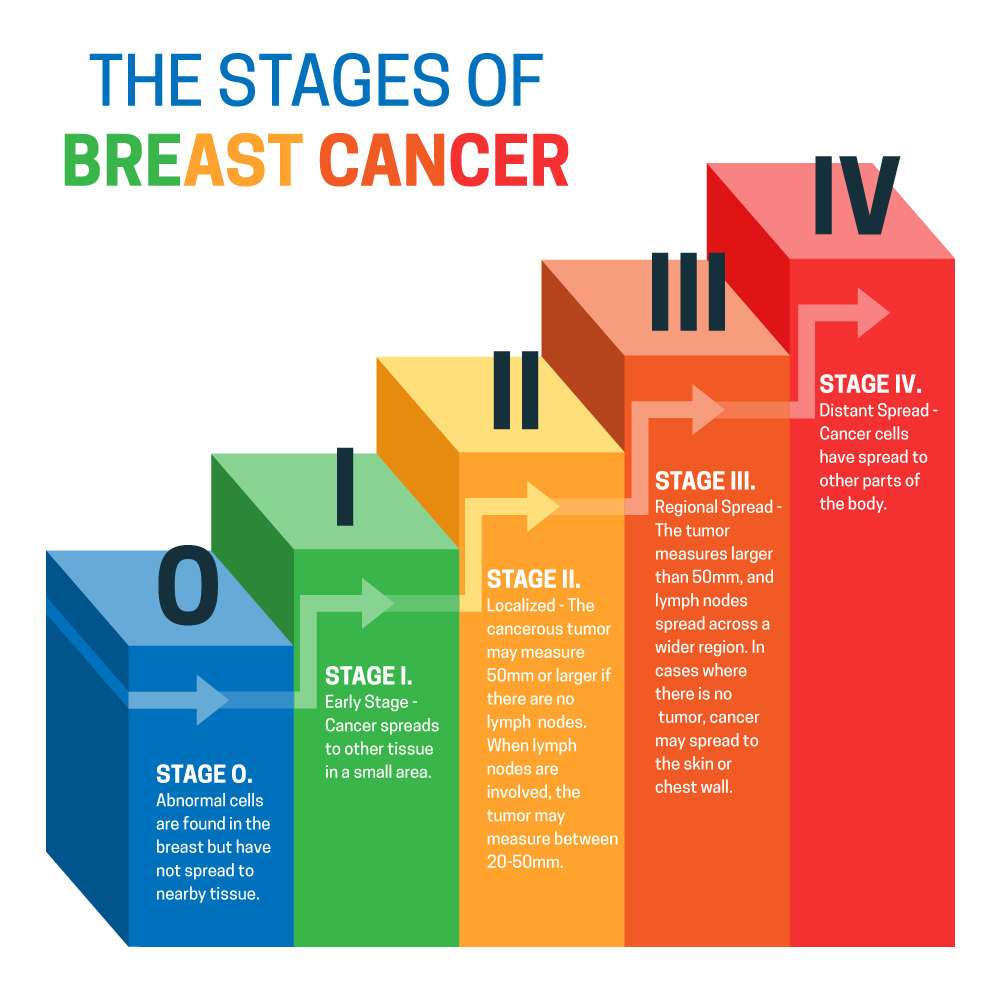 Understanding the 5 Stages of Breast Cancer and Prognosis