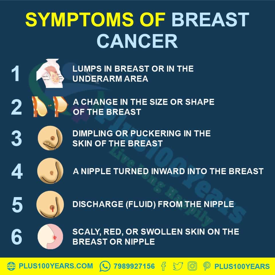 What are the Causes ,Symptoms and Prevention of Breast Cancer