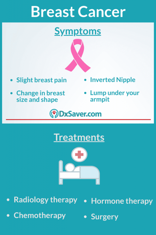 What are the Stages of Breast Cancer?