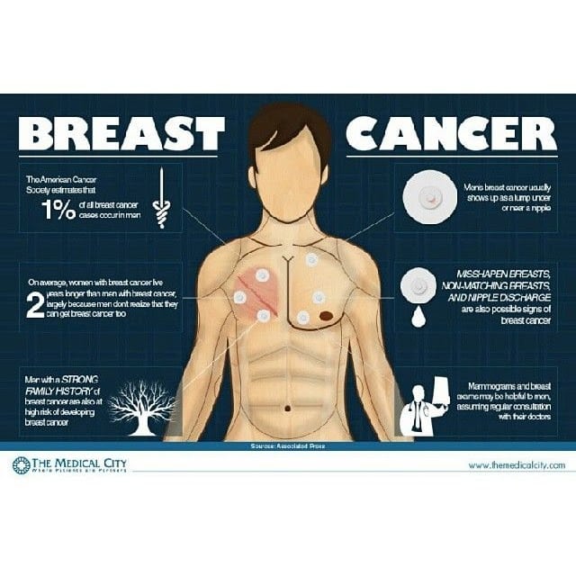 What Are The Symptoms Of Breast Cancer For Male