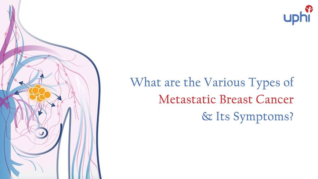 What Are The Various Types Of Metastatic Breast Cancer &  Its Symptoms?