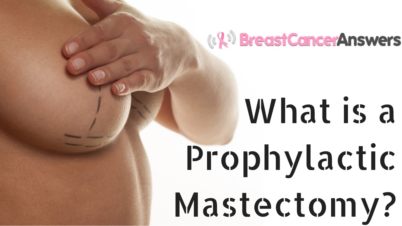 What is a Prophylactic Mastectomy?