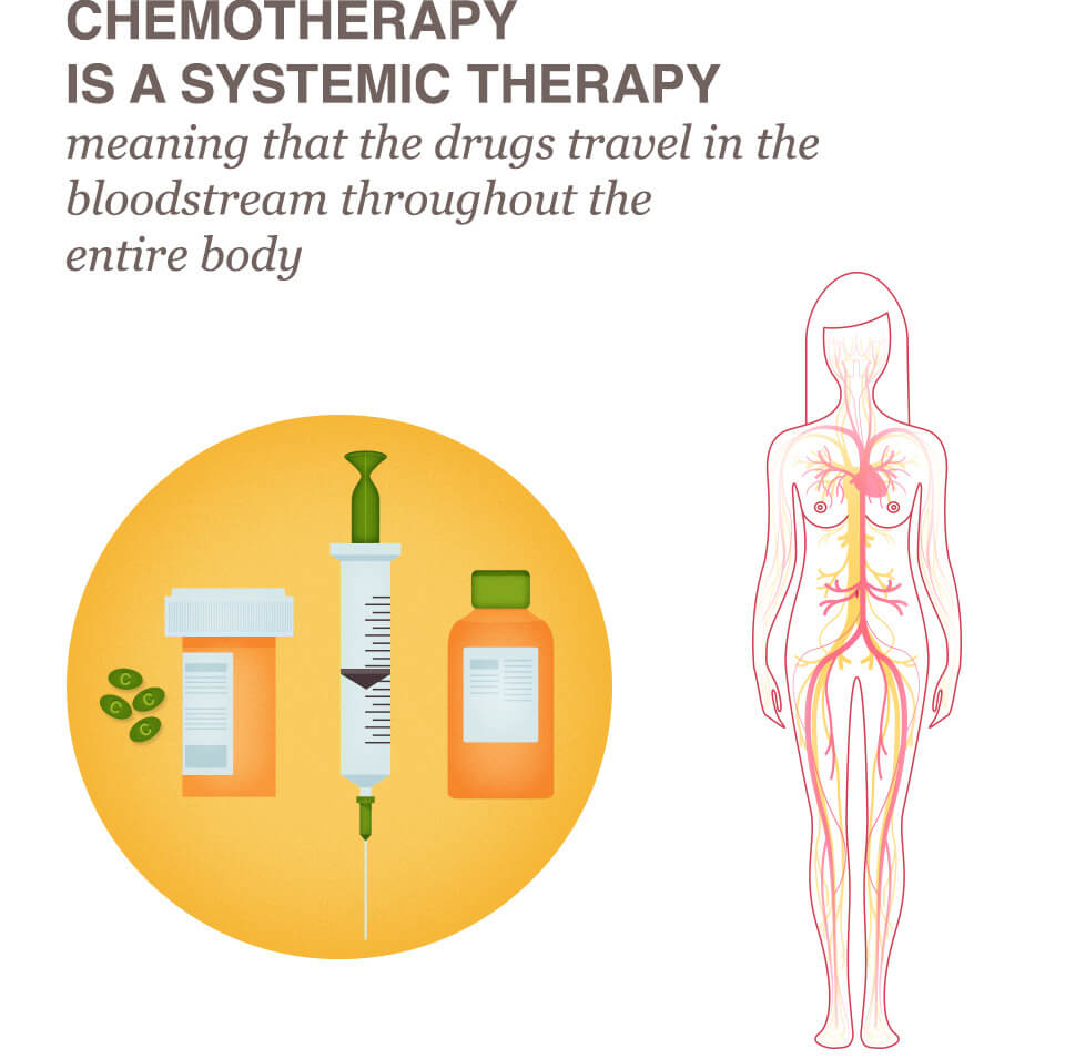 What Stage Of Breast Cancer Requires Chemotherapy ...