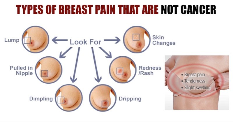 When to Worry About Sharp Pain in Breast or Mastodynia ...