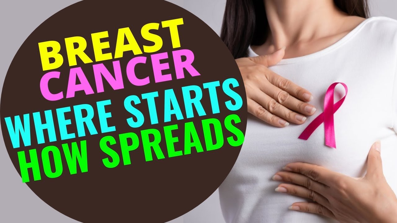 Where Breast Cancer Starts and Spreads