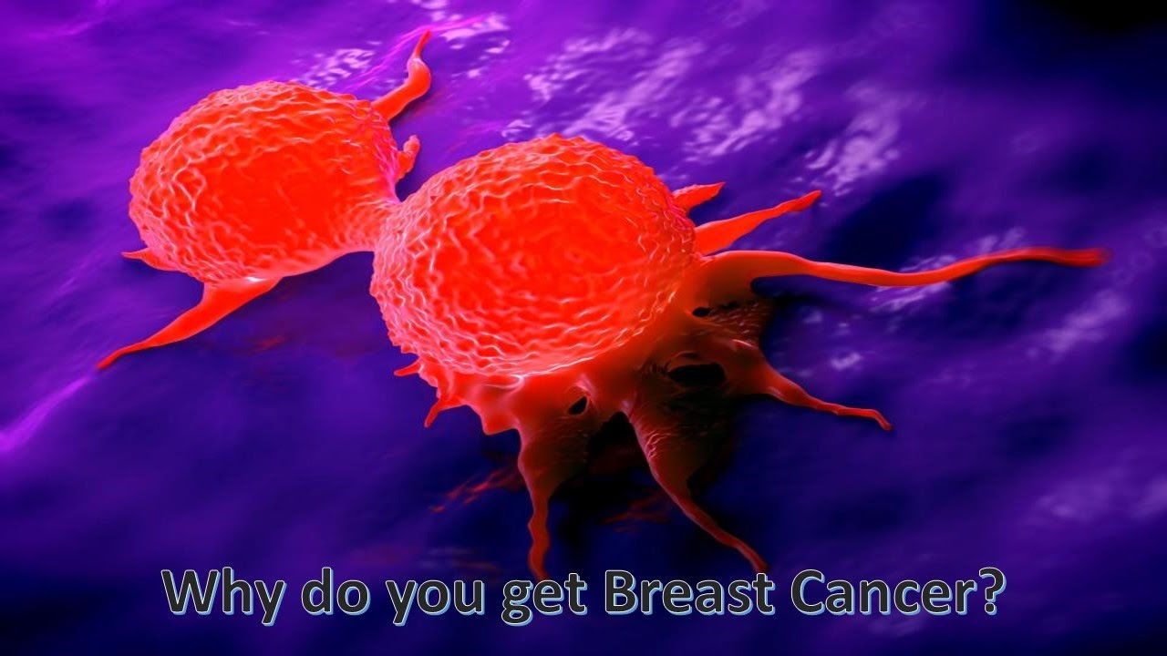 Why do you get Breast Cancer?