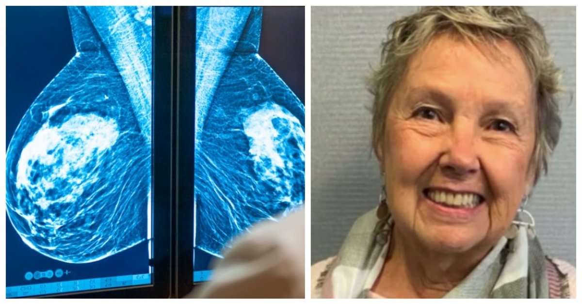 Woman Died From Stage IV Breast Cancer After Doctor Misread Her ...