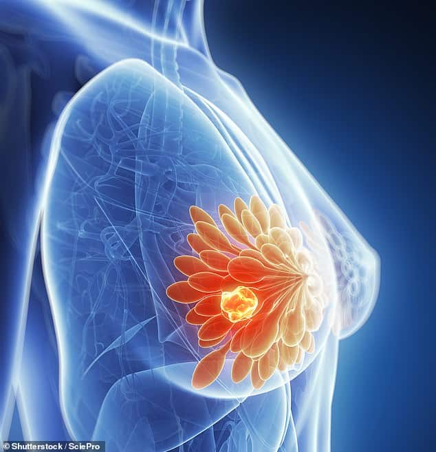 Women with incurable breast cancer will benefit from new drug which can ...