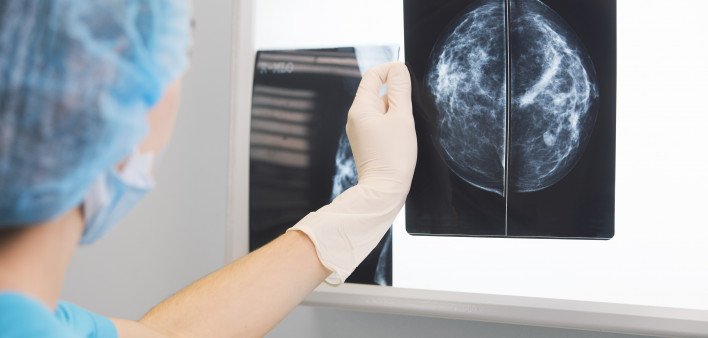 Women With Inflammatory Breast Cancer Are Living Longer ...