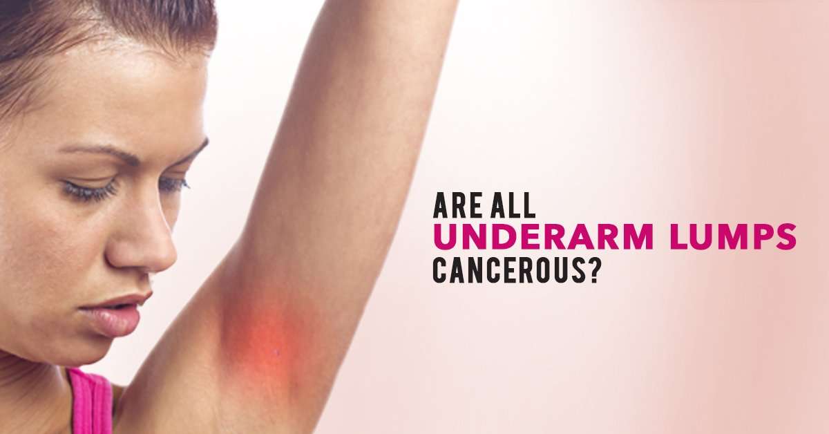 Worried About an Underarm Lumps? Find out What It Means